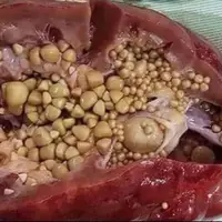 مواد غذایی که از تشکیل سنگ کلیه جلوگیری می‌کند