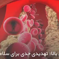 چربی خون بالا؛ تهدیدی جدی برای سلامت جامعه 