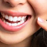 با این ویتامین‌ها دندان‌هایی مثل برف داشته باشید