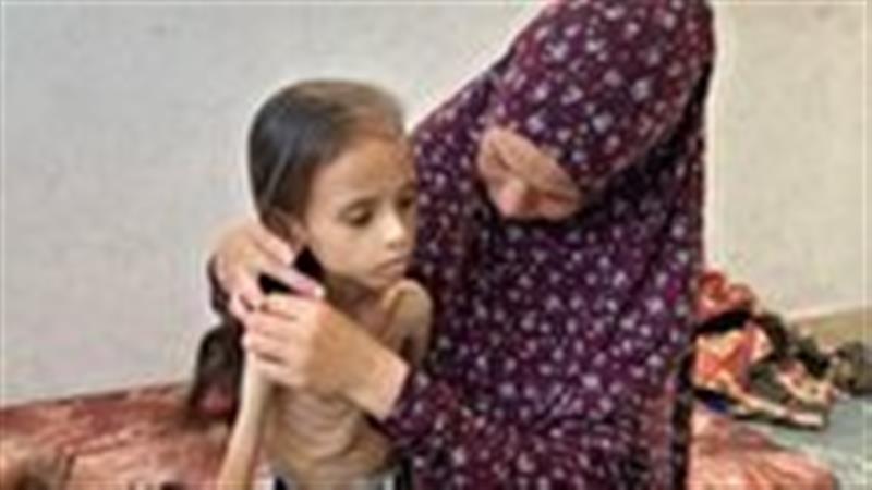یونیسف: ۱۳ هزار کودک در غزه از سوء تغذیه شدید رنج می‌برند