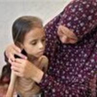 یونیسف: ۱۳ هزار کودک در غزه از سوء تغذیه شدید رنج می‌برند