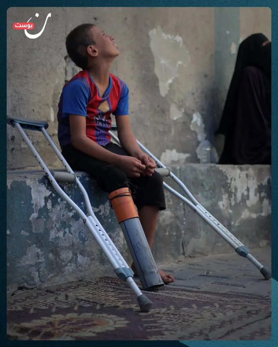 عکس/ لوله پلاستیکی، جای پای قطع شده کودک فلسطینی