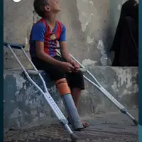 عکس/ لوله پلاستیکی، جای پای قطع شده کودک فلسطینی