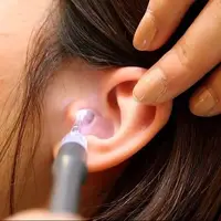 سرطان لاله گوش چیست و چه علائمی دارد؟
