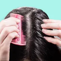پوسته‌های سر به دلیل شوره است یا خشکی پوست؟
