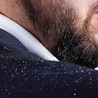 آشنایی با شوره سر به زبانی ساده!