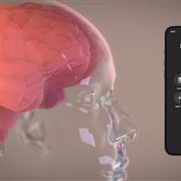 آزمایش جدید نورالینک، افکار شما را روی صفحه ظاهر می‌کند