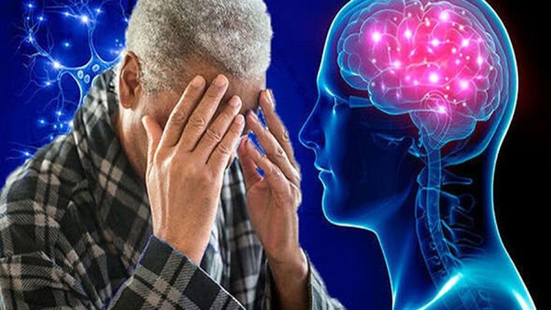 متخصص مغز و اعصاب : آلزایمر با درمان زودهنگام قابل کنترل است
