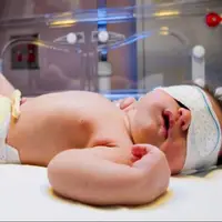 یکی از علل زردی نوزاد مربوط به گروه خونی مادر و نوزاد است