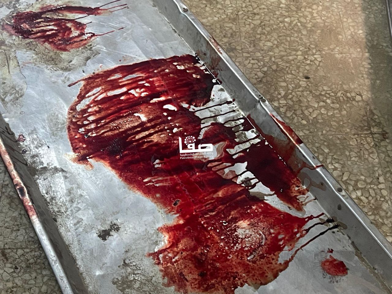 تصاویر قتل‌عام ۳ خانواده فلسطینی در غزه توسط اسرائیل 