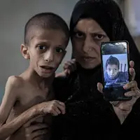 آمار شوکه‌کننده جان‌باختگانِ گرسنگی در غزه