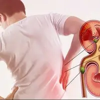 هنگام درد شدید کلیه چه کاری انجام بدهیم؟ 