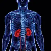 چگونه تشخیص دهیم دچار نارسایی حاد یا نارسایی مزمن کلیه هستیم؟ 
