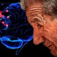 آیا سلول‌های بنیادی می‌تواند آلزایمر و پارکینسون را درمان کند؟