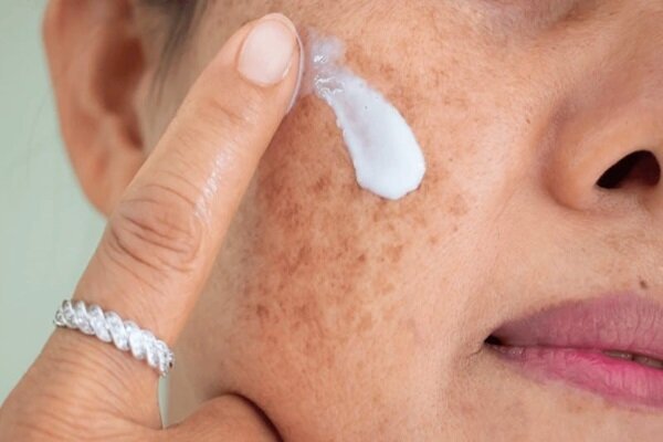 با منافذ باز پوست چه کنیم؟