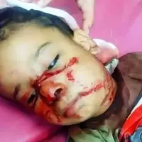 حمله سگ‌های ولگرد به کودک ۴ ساله در شوش 