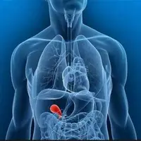 راه کاهش سطح صفرا که در بدن باعث خارش شده است