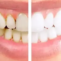 جرم‌گیری و همه شبهات آن!
