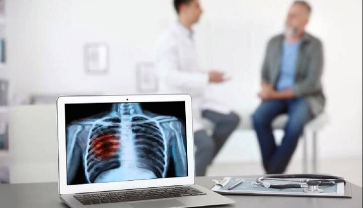 پرتودرمانی، جایگزینی قوی برای جراحی در سرطان ریه