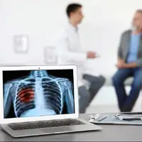 پرتودرمانی، جایگزینی قوی برای جراحی در سرطان ریه