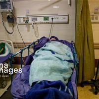 آغاز رسیدگی به پرونده جانبازی ۶۸ مجروح جنگ ۱۲ روزه در فارس؛ یک نفر جانباز ۷۰ درصد اعلام شد