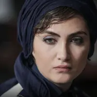 چهره متفاوت سیمایِ «زخم کاری» در جدیدترین عکسش
