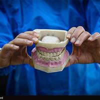 دانش‌آموزان دبستانی به طور میانگین 5 دندان پوسیده دارند/اجرای پویش سلامت دهان از هفته آینده