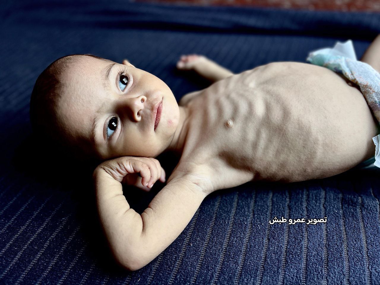 عکس/ کودکان بی‌دفاع غزه