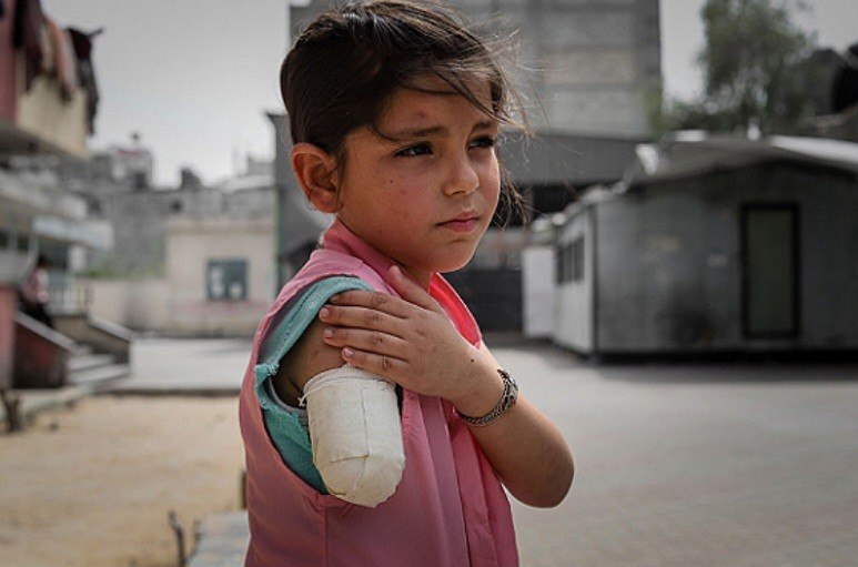 عکس/ کودکان بی‌دفاع غزه