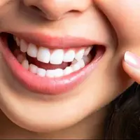 خوراکی‌های مفید برای سلامت دندان