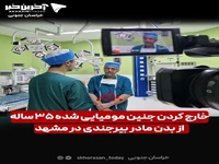 فیلم/ خارج کردن جنین مومیایی شده ۳۵ ساله از بدن مادر بیرجندی در مشهد 