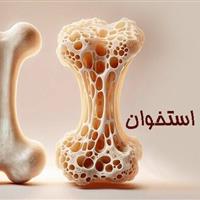 کم‌تحرکی، عامل اصلی پوکی استخوان در ایلام