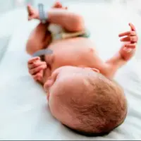 تاثیر صدای مادر بر تقویت رشد مغز نوزادان نارس