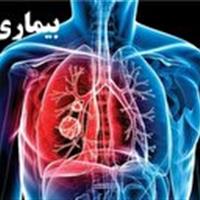 بیماری سل همچنان یک اولویت بهداشتی در کشور است