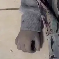 آتش‌بس شد... اما کودکان همچنان قربانی