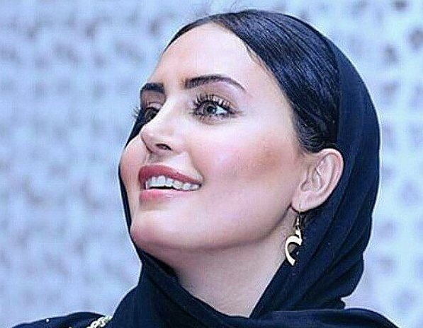 الناز شاکردوست ناگهان از قیافه افتاد!