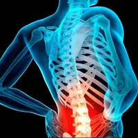 سریع ترین روش تشخیص دیسک کمر!