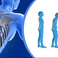 ادغام برنامه ملی کنترل پوکی استخوان در نظام مراقبت‌های اولیه سلامت