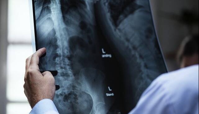 رییس انجمن رادیولوژی: تعرفه خدمات تصویربرداری متناسب با تورم رشد نکرده است