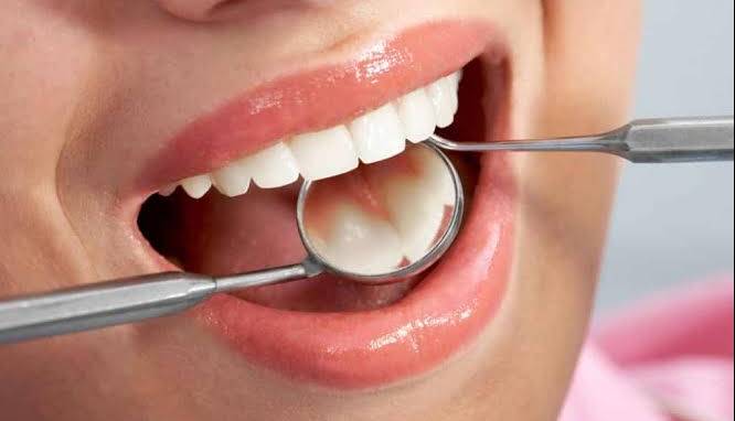 احتمال ابتلا به سرطان با رعایت نکردن بهداشت دهان  و دندان