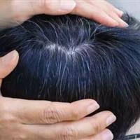 یافتهای جدید درباره سفید شدن مو