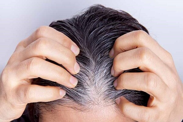 یافتهای جدید درباره سفید شدن مو