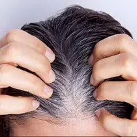 یافتهای جدید درباره سفید شدن مو