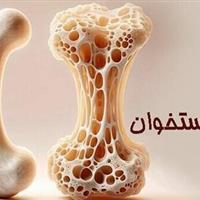 پوکی استخوان؛ تشخیص و درمان به موقع