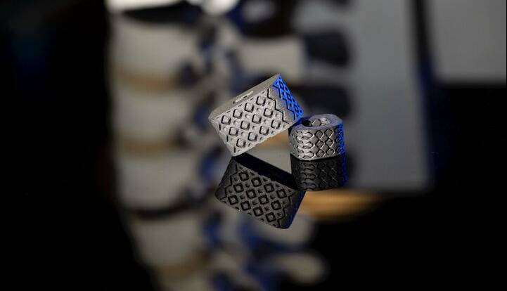 ایمپلنتی که وضعیت ستون فقرات را از درون بدن گزارش میکند