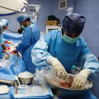 اهدای کبد بیمار مرگ مغزی در مراغه