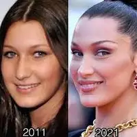 مقصران افتادن کودکان در دام عملزیبایی