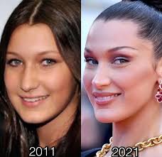 مقصران افتادن کودکان در دام عملزیبایی