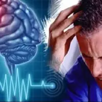 ۱۱ عامل بروز سکته مغزی را بشناسید