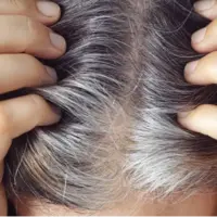خاکستریشدن موها احتمالاً رویکرد طبیعی بدن برای مقابله با سرطان است